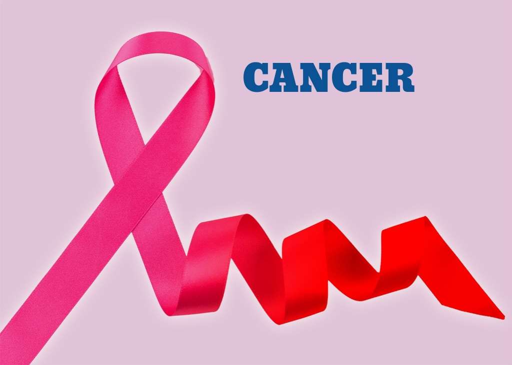 Cancer Cause, Prevention , Risk Factor & Treatment