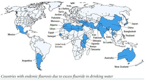 Flurosis affected countries