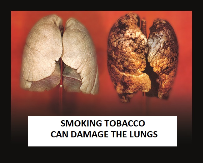 Tobacco ill effect on lungs
